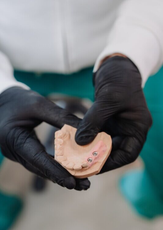 dente mancante, impianto dentale